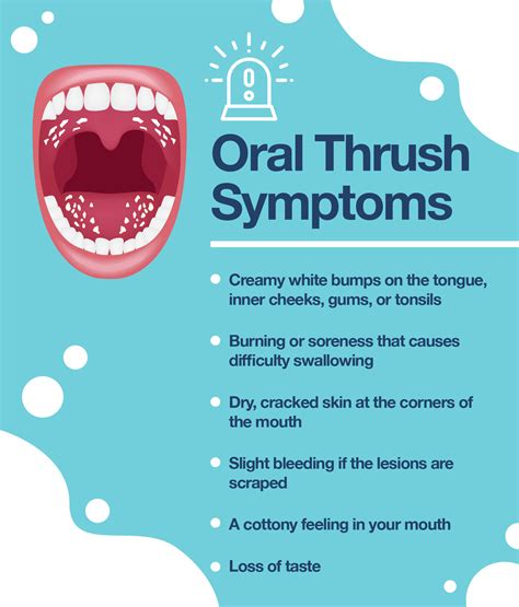 How serious is oral thrush