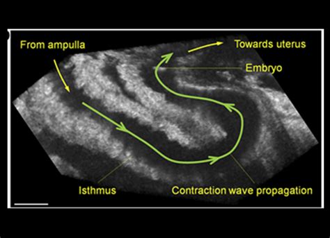 How the egg and the embryo actually travel through the fallopian …