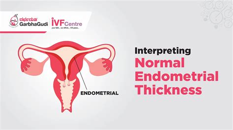 How thick endometrial lining should be