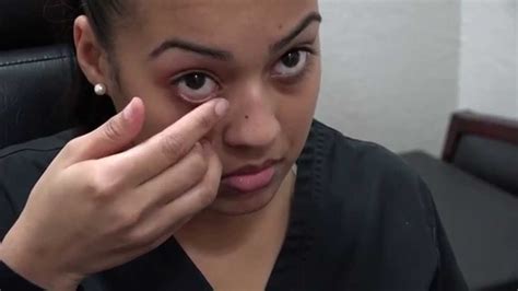 How to Apply Ointment to the Eyes and Eyelids - YouTube