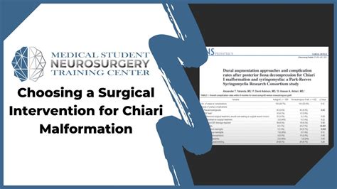 How to Choose a Neurosurgeon for Chiari Malformation