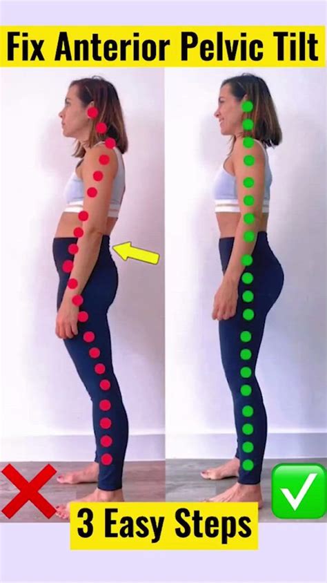 How to Do a Pelvic Tilt Techniques Benefits Variations