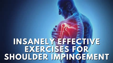 How to Fix Shoulder Impingement