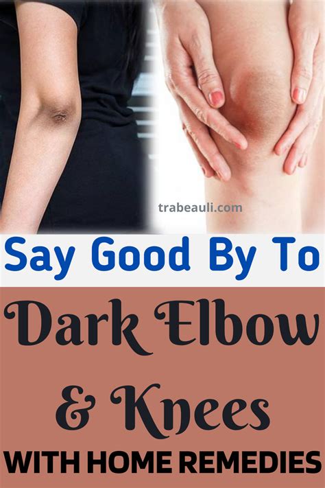 How to Get Rid Of Dark Elbows Fast, Home Remedies to Lighten …