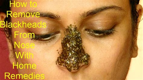 How to Get Rid of Blackheads on Your Nose in Six Ways