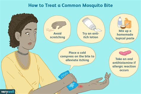 How to Get Rid of Mosquito Bites - Prevention