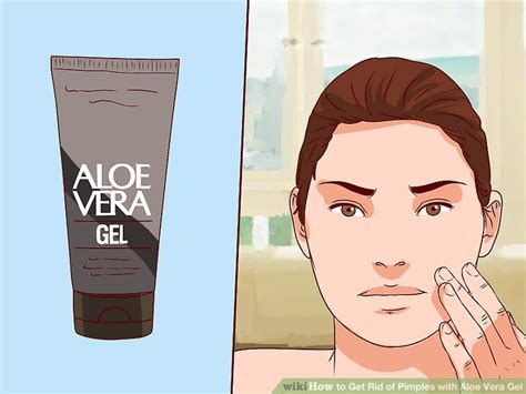 How to Get Rid of Pimples with Aloe Vera Gel: 6 Steps - WikiHow