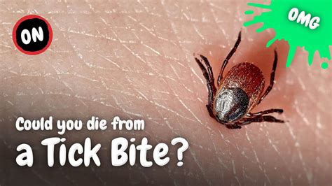 How to Know if You’ve Been Bitten by a Tick - Men