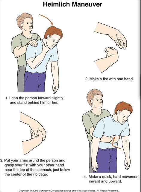 How to Perform the Heimlich Maneuver on Adults and Children: Abdominal …