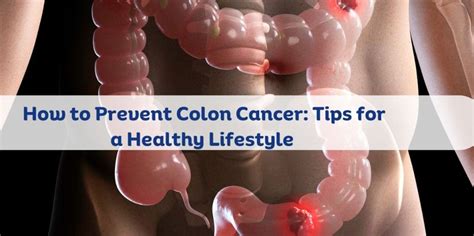 How to Prevent Colon Cancer Everyday Health