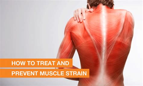 How to Prevent and Treat Muscle Sprains and Strains