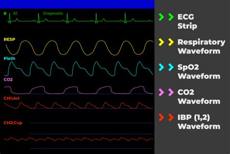 How to Read a Patient Monitor Numbers and Lines Explained
