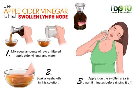 How to Reduce Lymph Node Swelling: 3 Best …