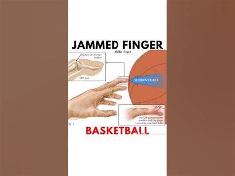 How to STOP Jammimg Fingers in Basketball #basketball #shorts