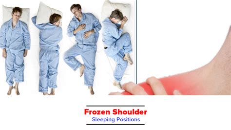 How to Sleep with a Frozen Shoulder Sleeping Positions