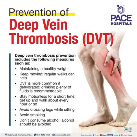 How to Spot and Prevent Deep Vein Thrombosis - NIH …