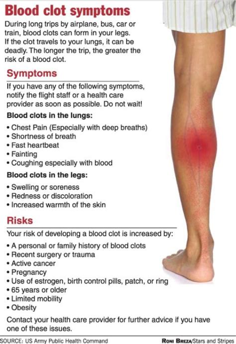 How to Tell if You Have a Blood Clot: Symptoms in Legs, Lungs, an…