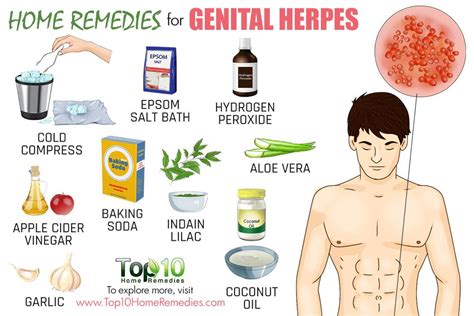 How to Treat Genital Herpes: Can Natural Remedies Help? - WikiHow