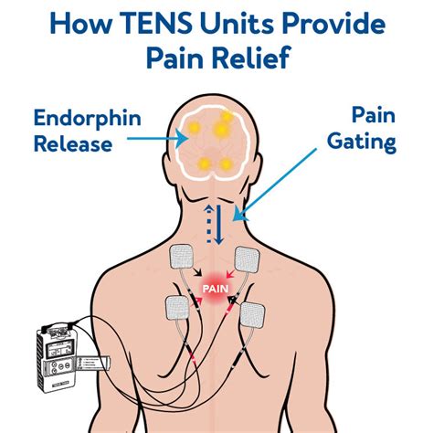 How to Use a TENS Unit with Heat for Increased Pain Relief Complete Guide