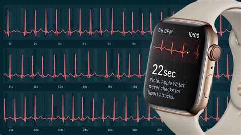 How to Use an Apple Watch ECG