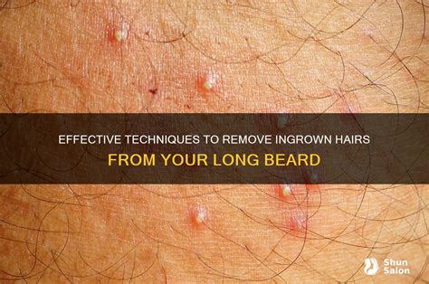 How to avoid ingrown hairs when using beard scissors