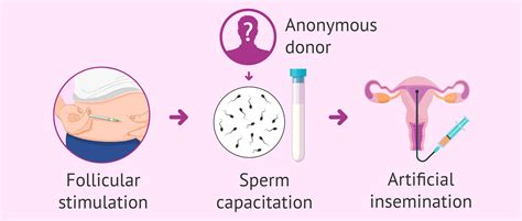 How to be a single mother? Fertility treatments and prices …