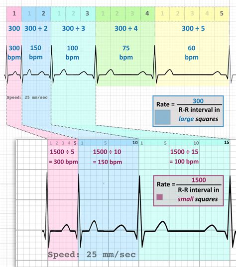 How to calculate atrial rate. Count the small squares between the crest of two adjacent “R” waves. The number of squares will be the same between each “R” wave in a regular heart. Divide 1500 by the number of squares you counted between two “R” waves. For example if you counted 25 boxes, the ventricular heart rate would be 1500 divided by 25 or 60 beats per ... 