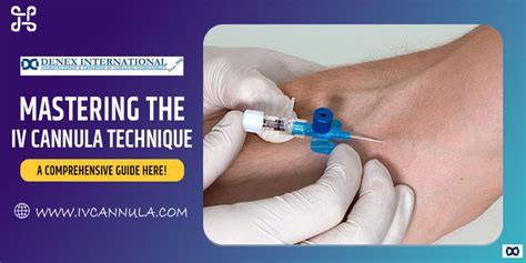 How to cannulate difficult veins.  Performing this Mastering IV Cannulation: A Gu...