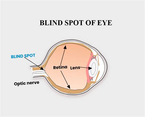 How to check blind spot in eye