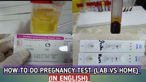 How to check pregnancy test in lab.Difference Between home and lab