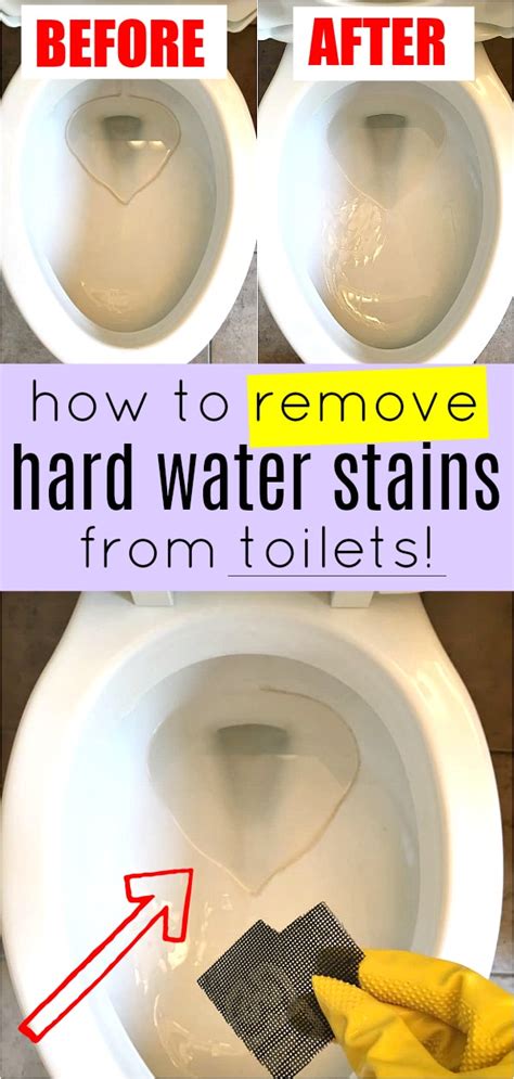 How to clean toilet ring. 2. Rub a baking soda paste onto any leftover stains, then rinse with vinegar. Soak paper towels in vinegar and stick them to the stains for 4 hours. Mix baking soda and water until it forms a thick paste. Take off the paper towels, rub the paste into the stained areas with a cloth, then wait 5-10 minutes. 