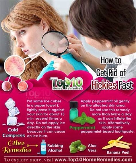 How to cover a hickey. Things To Know About How to cover a hickey. 