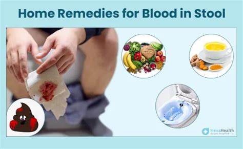 How to cure bleeding in stool