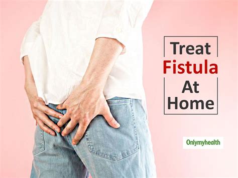 How to cure fistula permanently at home. 