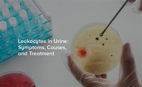 How to cure leukocytes in urine