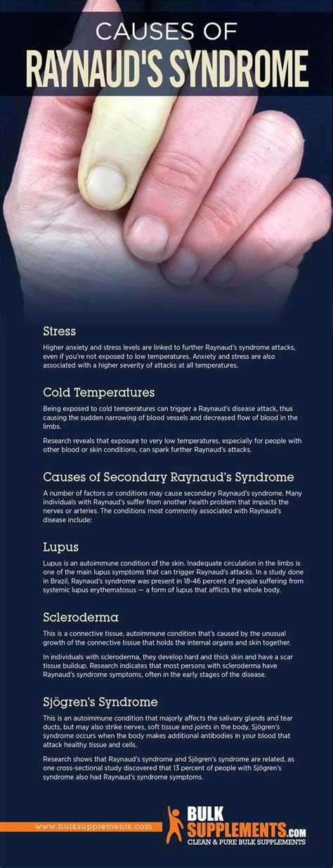 How to deal with Raynaud