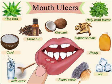 How to deal with ulcers in mouth