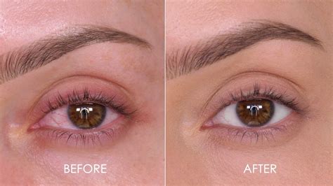 How to decrease redness in eyes