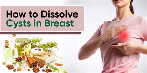 How to dissolve cysts in breast. .  <a href=https://blog.dev-nanuk.com/wp-includes/ID3/g0lr/w...