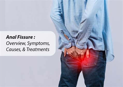 How to do anal to avoid pain. .  ...