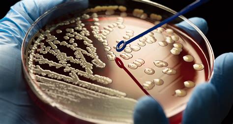 How to do phd in microbiology