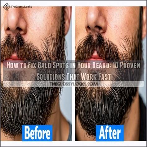 How to fix bald spots in beard