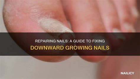 How to fix nails growing down.  Our expert explains the top reasons, from ...