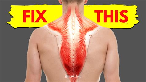 How to fix tight muscles in back