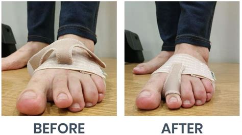 How to fix toe in alignment