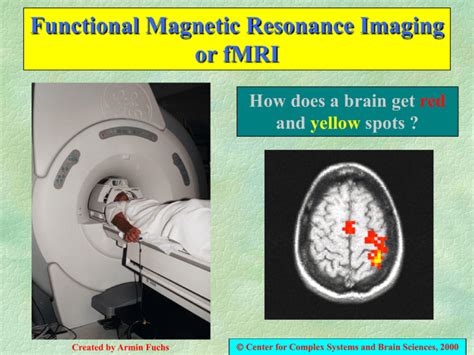 An fMRI scan is a functional magnetic resonance imaging scan that measures and maps the brain’s activity. An fMRI scan uses the same technology as an MRI scan. An MRI is a noninvasive test that uses a strong magnetic field and radio waves to create an image of the brain. The image an MRI scan produces is just of organs/tissue, but an fMRI ... 