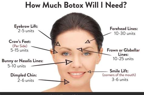 How to get jaw botox covered by insurance. Things To Know About How to get jaw botox covered by insurance. 