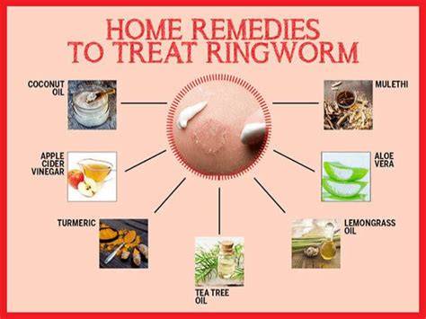 How to get rid of ringworm permanently naturally.  Included is detail ...