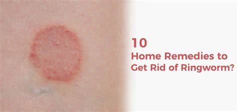 How to get rid of ringworm permanently naturally.  It initially appears as red pat...