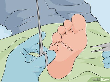 How to heal cut in between toes